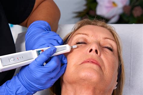 nano plasma eye lift.